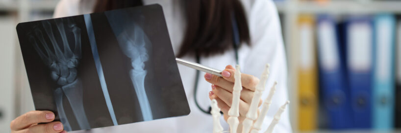 Traumatologist in uniform examine patient scan, prepare conclusion